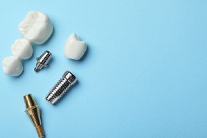A dental bridge and dental implant on a pale blue background